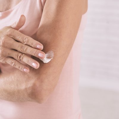 Donna anziana applica una crema sulla pelle secca del braccio